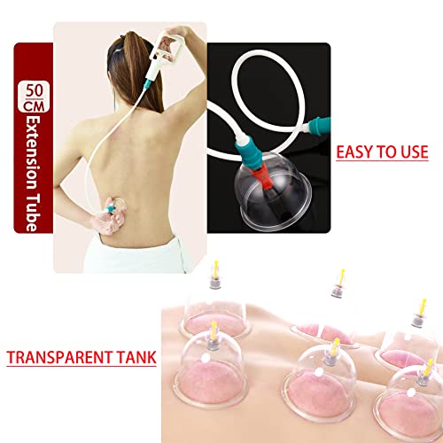 MYMM 12 Cupping Cups Sets Biomagnetic Traditional Professional Chinese Therapy Massage
