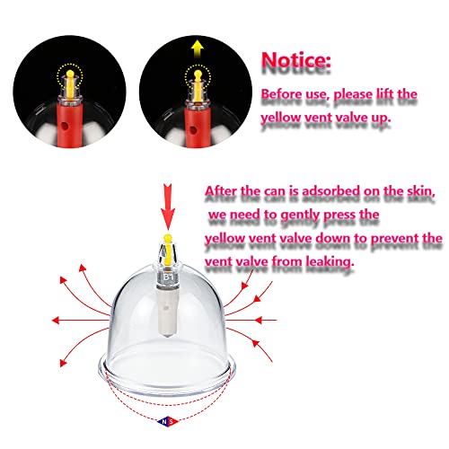 MYMM 12 Cupping Cups Sets Biomagnetic Traditional Professional Chinese Therapy Massage