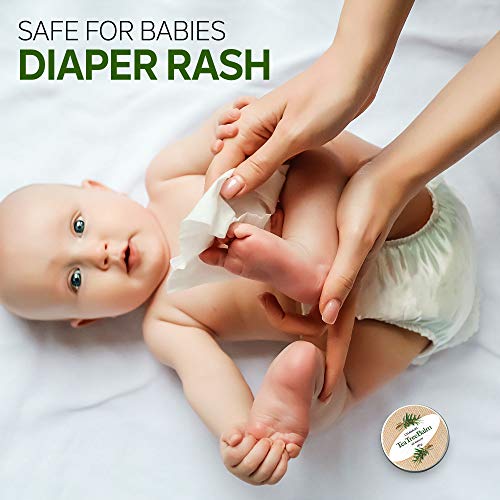 TEA TREE OIL BALM -100% All Natural | Great Cream for Soothing Irritations like Eczema