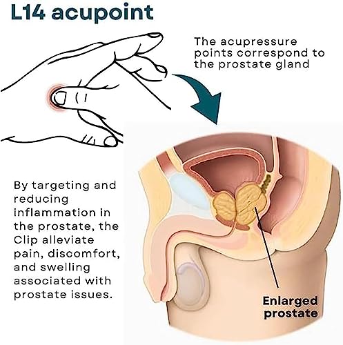 XEYOW Prostate Care Point Clip for Men, Acupressure Hand Pressure Point Clip, Relieve Prostate