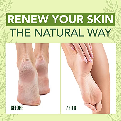 Tea Tree Oil Foot Cream For Dry Cracked Heels Repair - Natural Foot Cream For Dry Cracke