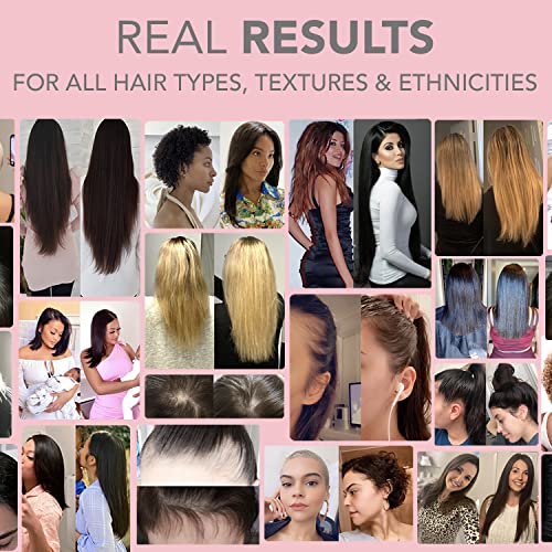 HAIRtamin MOM Vegan Prenatal & Postnatal Multivitamin Supplement & Hair Vitamin Pregnancy