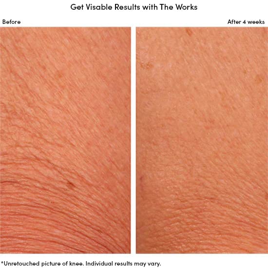 Womaness Summer Skin Bundle - The Works - Menopause Support Skincare Hydrating Body Lotion