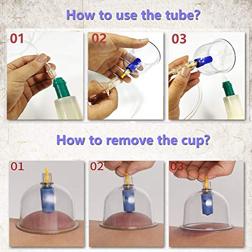 MYMM 12 Cupping Cups Sets Biomagnetic Traditional Professional Chinese Therapy Massage