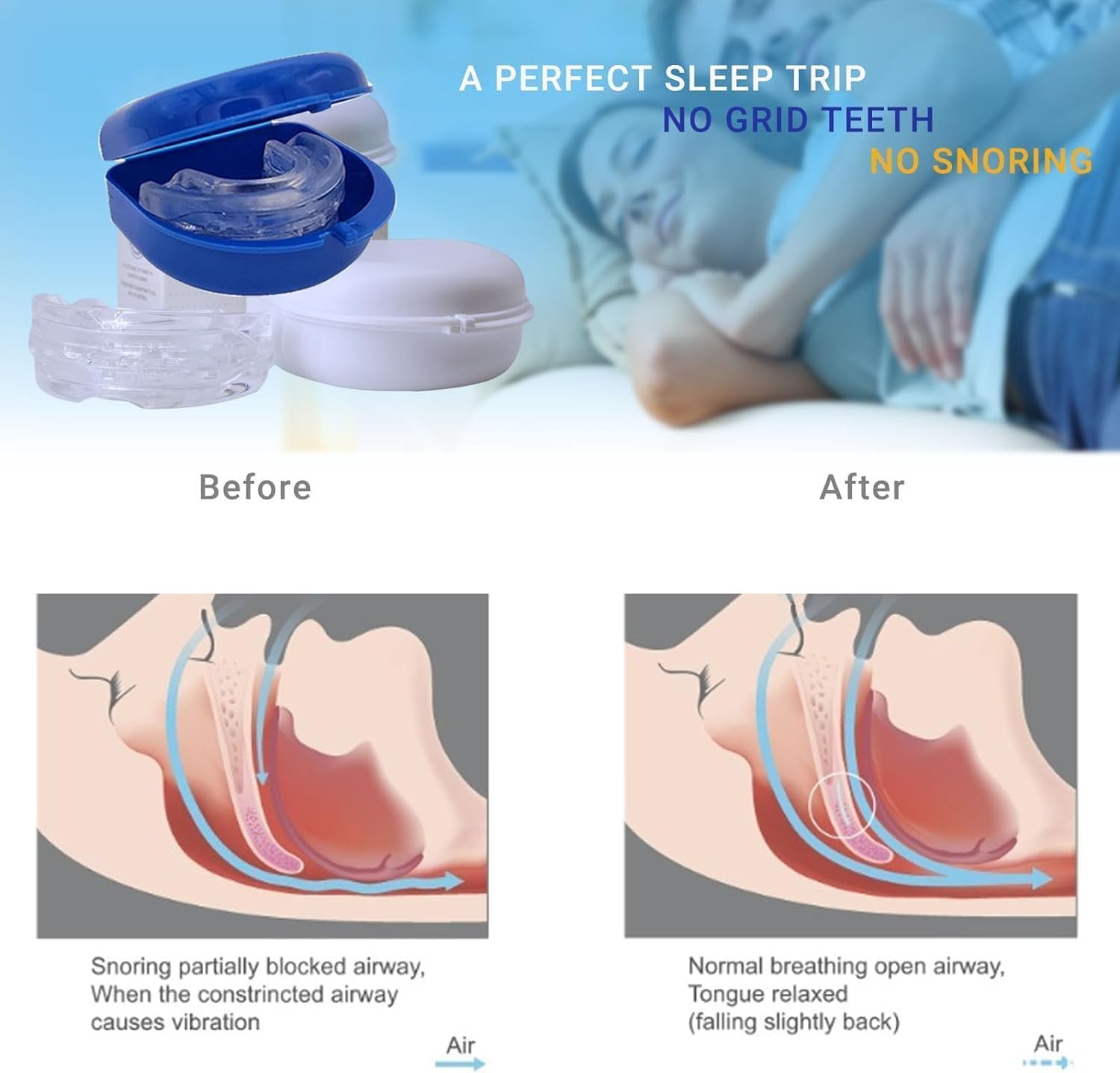 SereneSleep Mouthpiece (Blue)