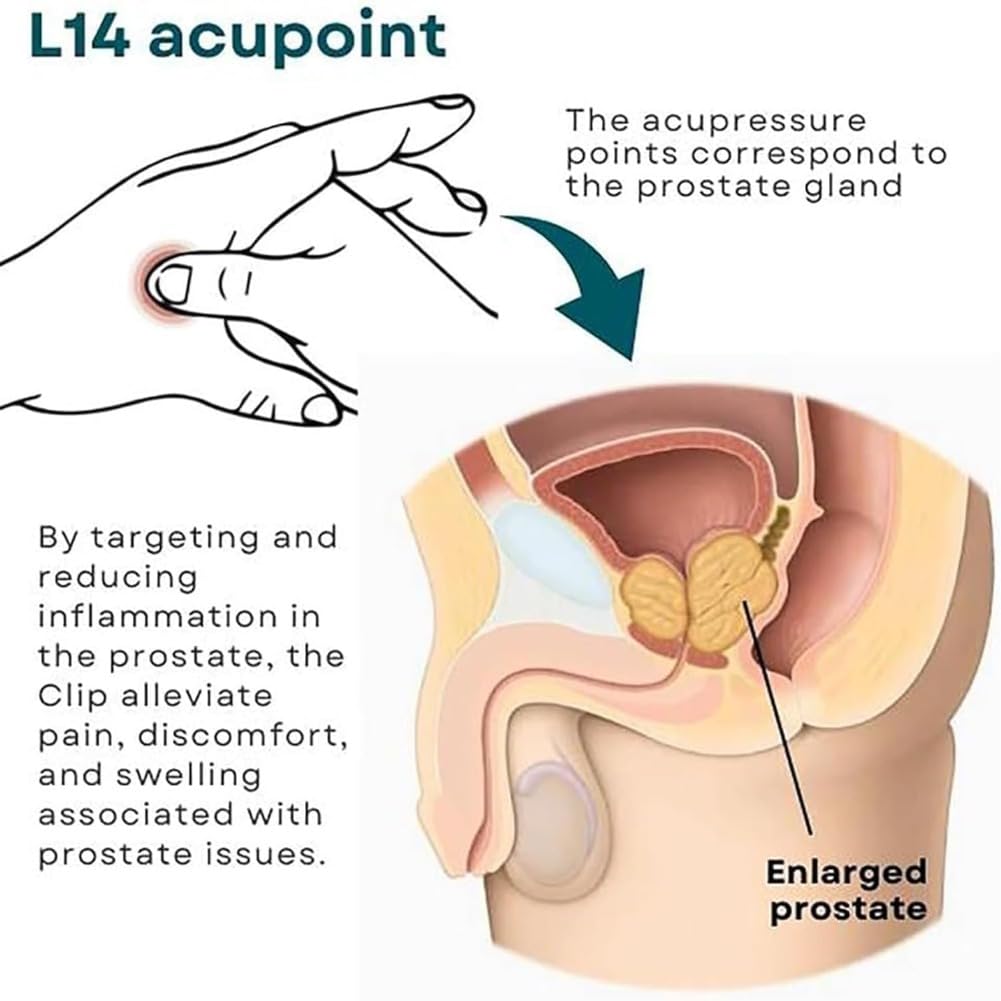 2pcs Prostate Care Point Clip for Men,Acupressure Hand Pressure Point Clip, Relieve Prostate