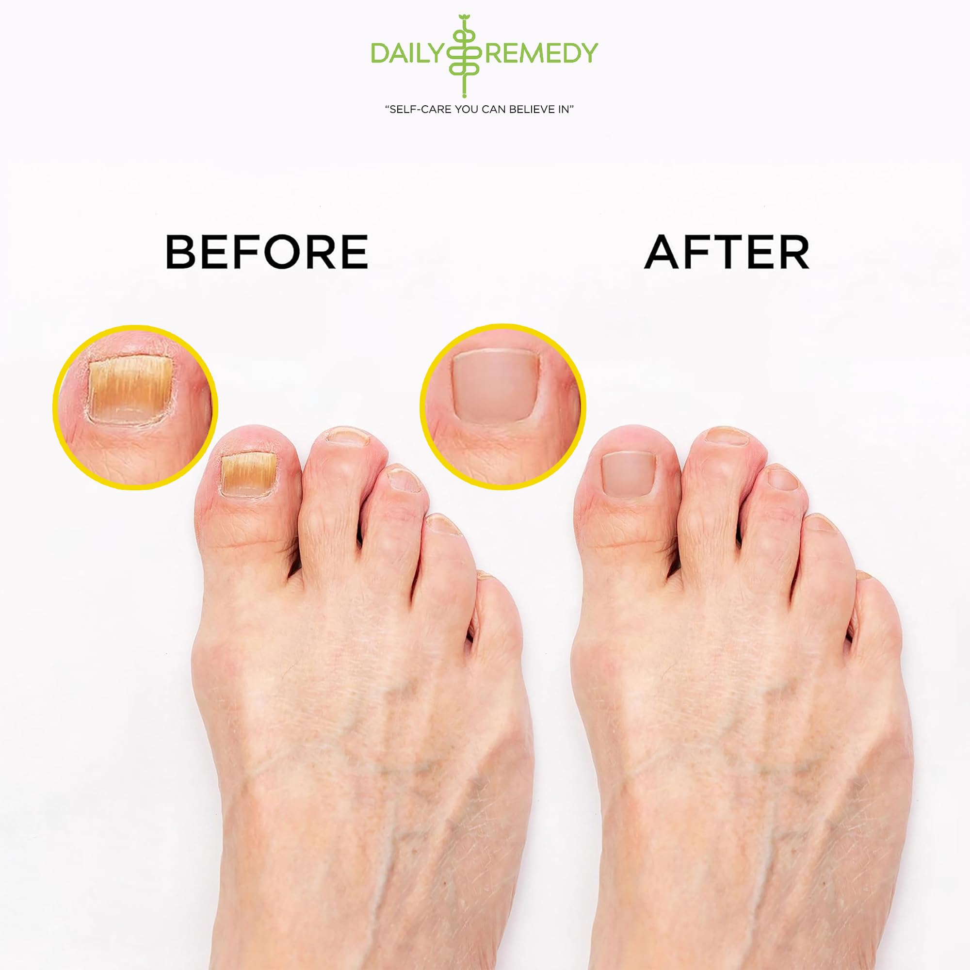 Citrus Detox Foot Soak with Epsom Salt - for Foot Callus, Immune Boost, Damaged Toenail