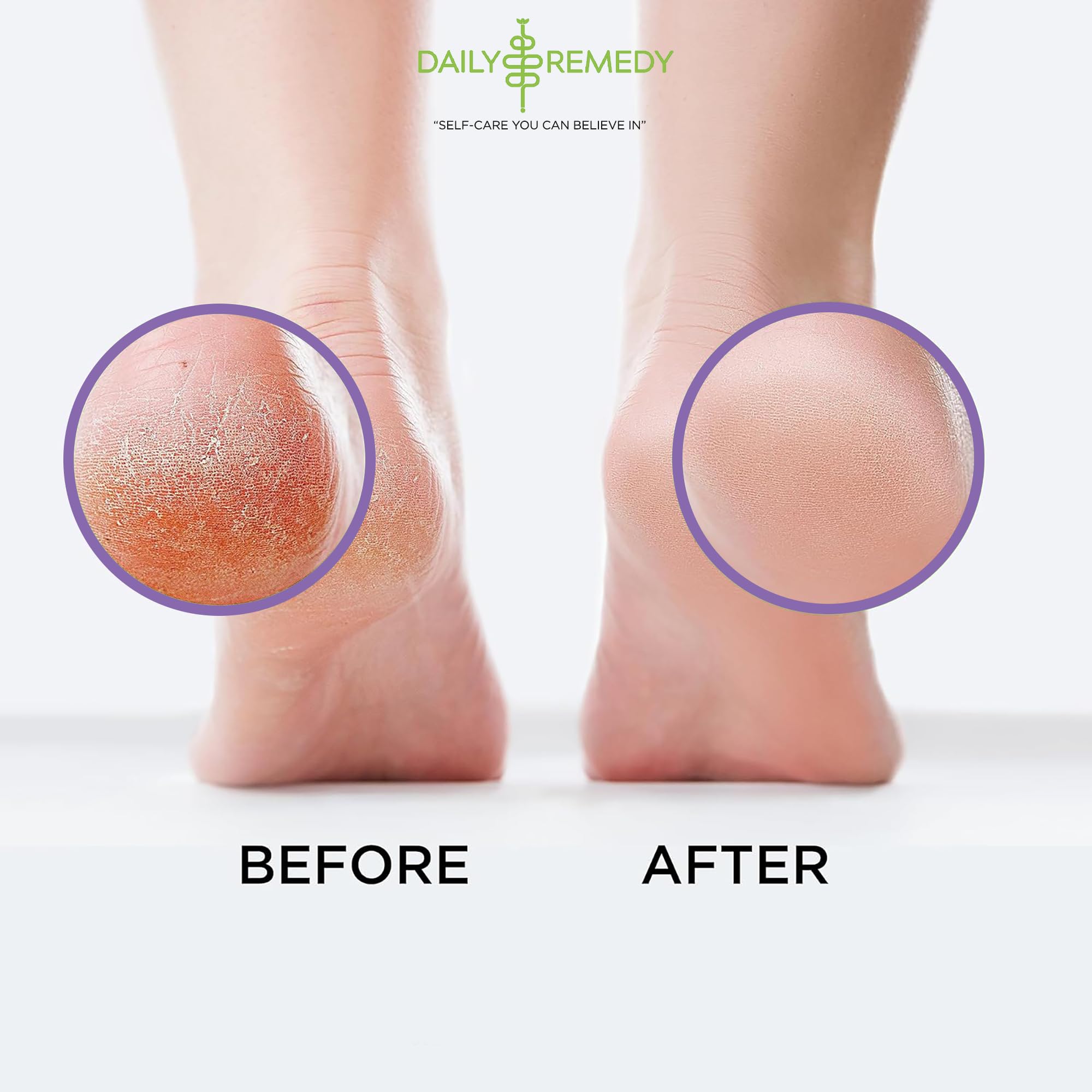 Calming Lavender Foot Soak with Epsom Salt, Made in USA, Foot Soak Soothes Sore Tired