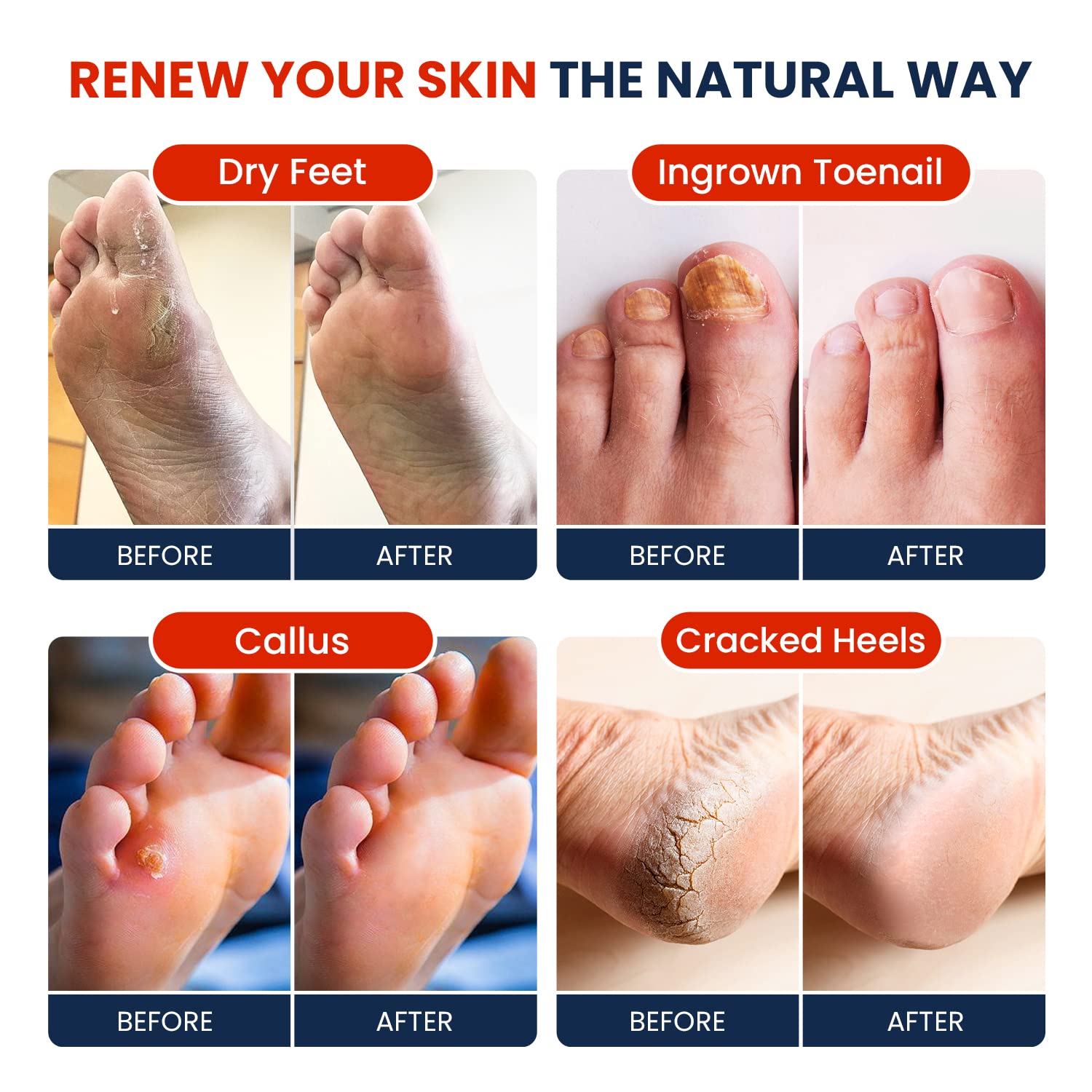 Muscle Relief Foot Soak with Epsom Salts - All Natural Salts for Post Workout Recovery