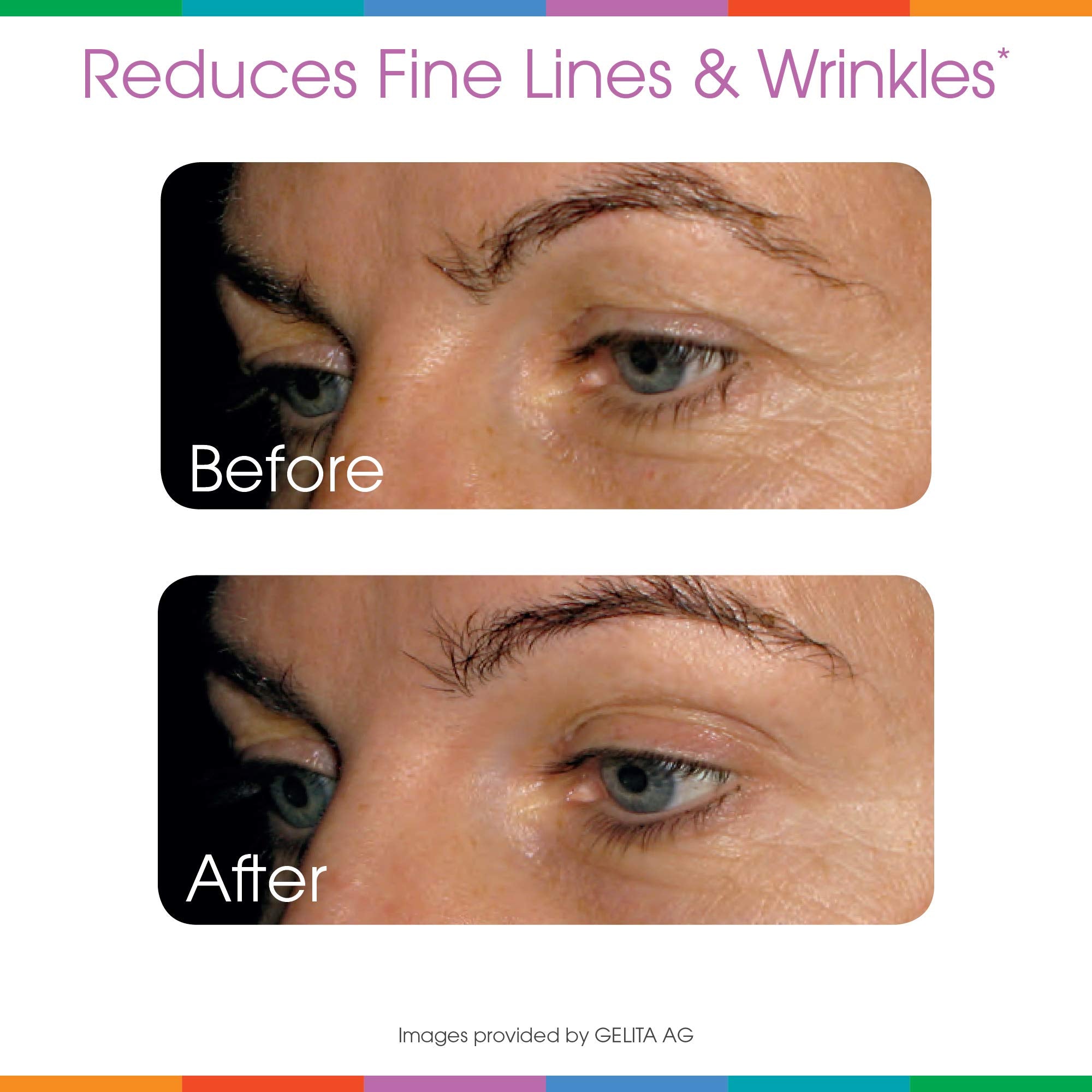 Hydrolyzed Collagen Powder - Sparkle Skin Boost Plus (Tropical Coconut Pineapple)