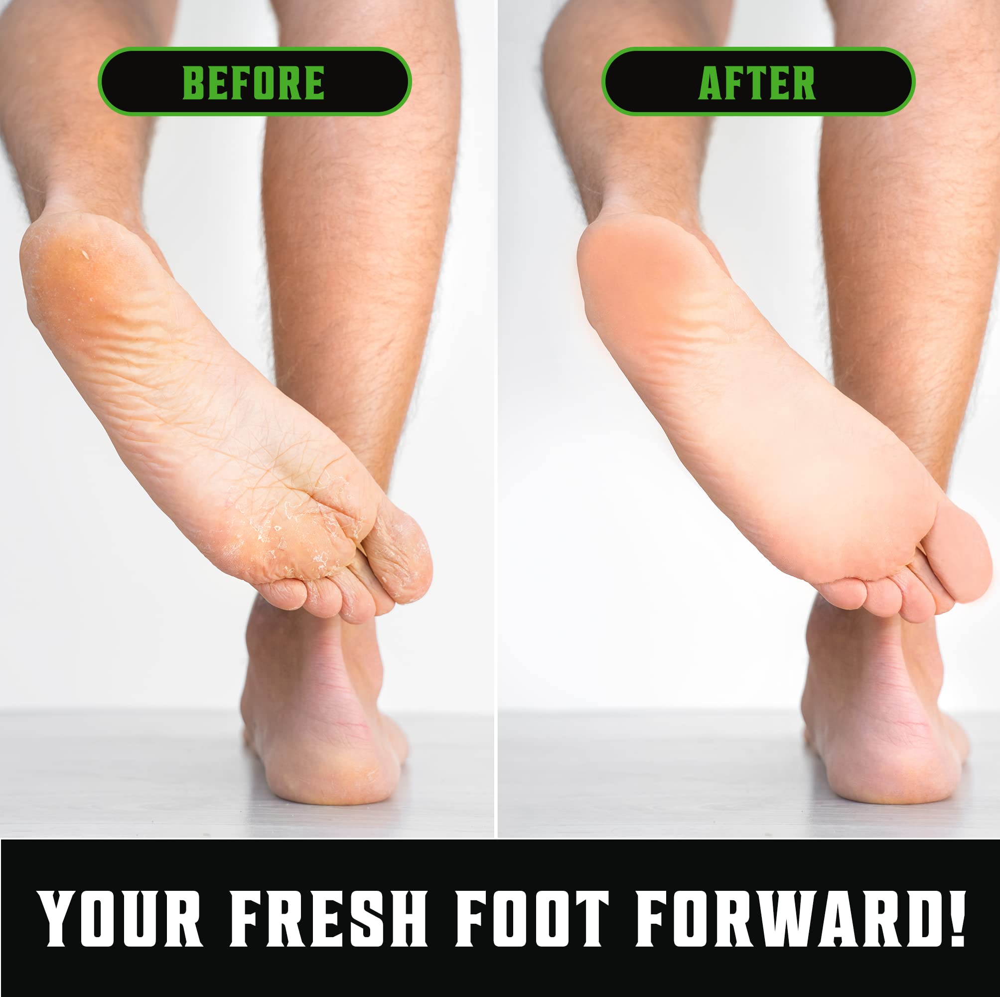 Viking Revolution Skin Cleaning Agent Tea Tree Kit for Men - Tea Tree Oil Set with Body