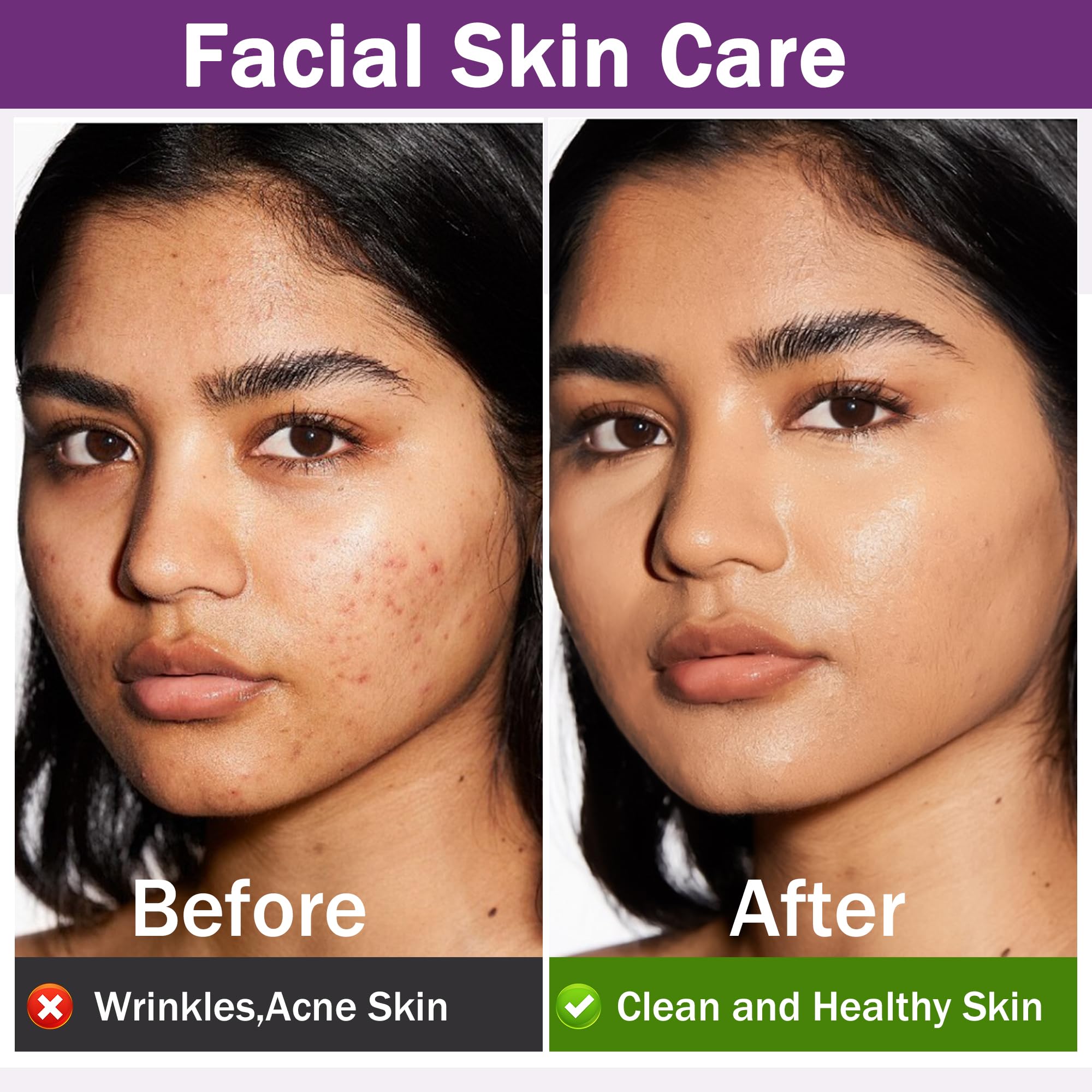 Rosemary Oil for Hair Growth,100% Pure Undiluted Light-Weight Non-Greasy Rosemary Essential Oil