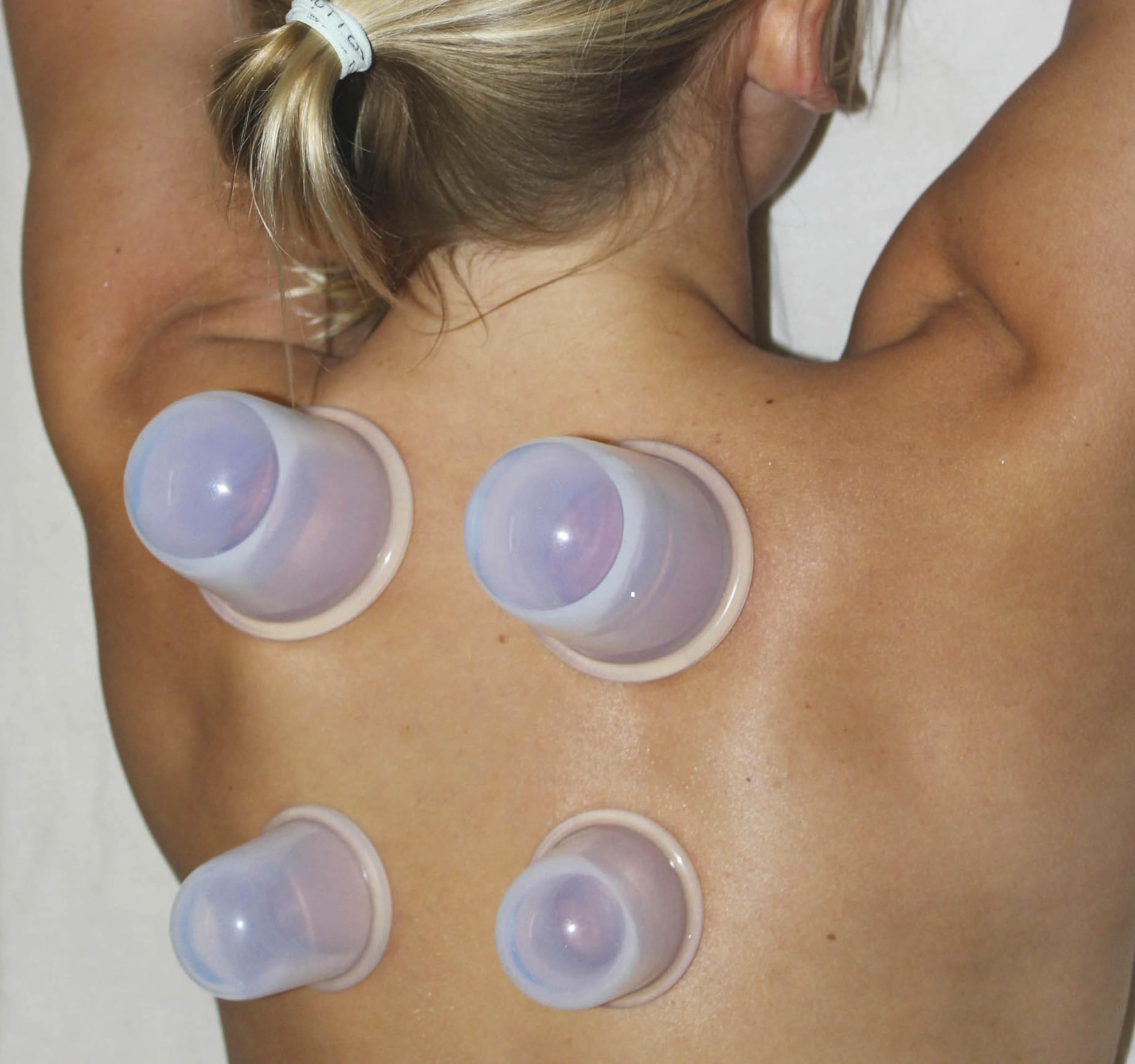 Cupping Kit for Massage Therapy - by DoSensePro, Cupping Set of 6 Professional Silicone Cups