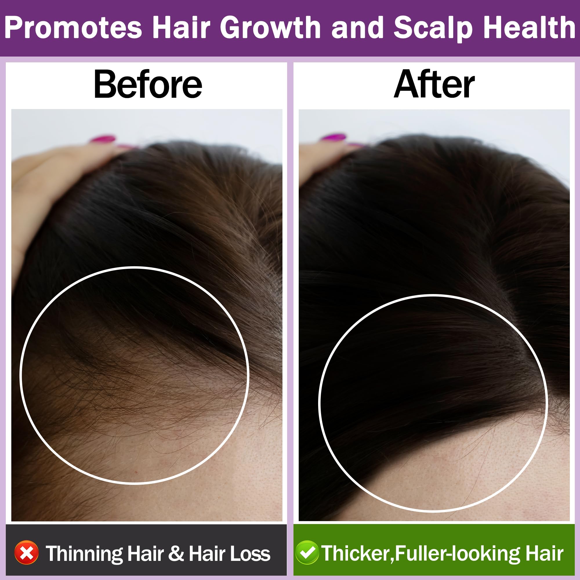 Rosemary Oil for Hair Growth,100% Pure Undiluted Light-Weight Non-Greasy Rosemary Essential Oil