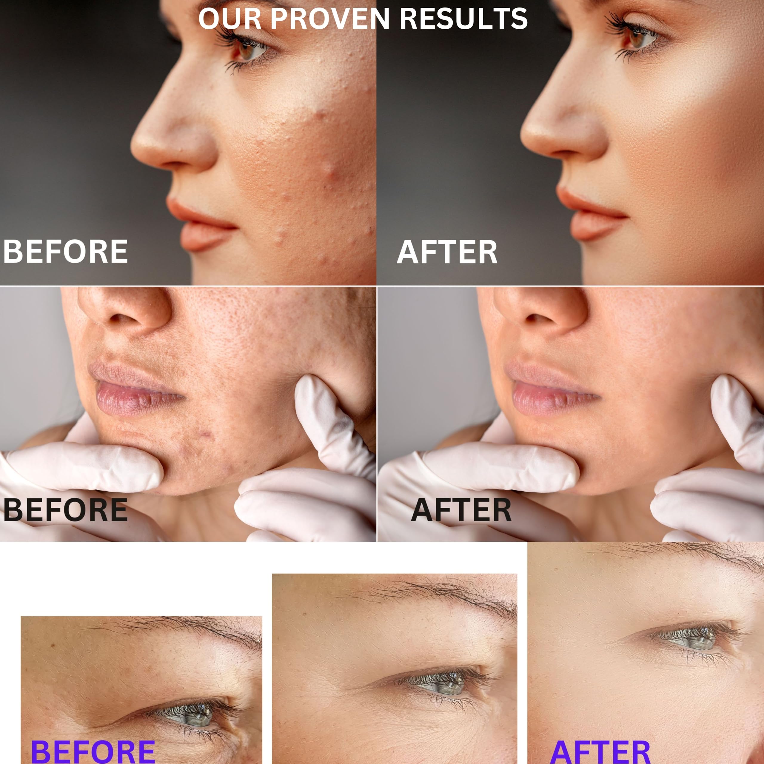 SkinVitalize C E ferulux Vitamin C Serum - 30ml: Advanced Formula for Fighting with Wrinkles