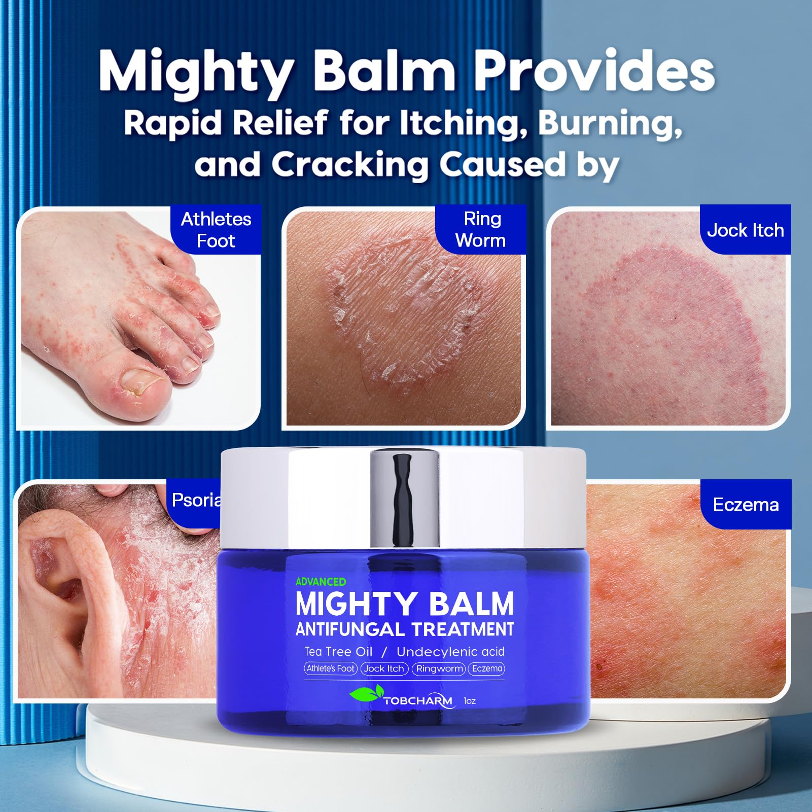 Tobcharm Antifungal Cream, Antifungal Cream for Skin, Ringworm Treatment for Humans