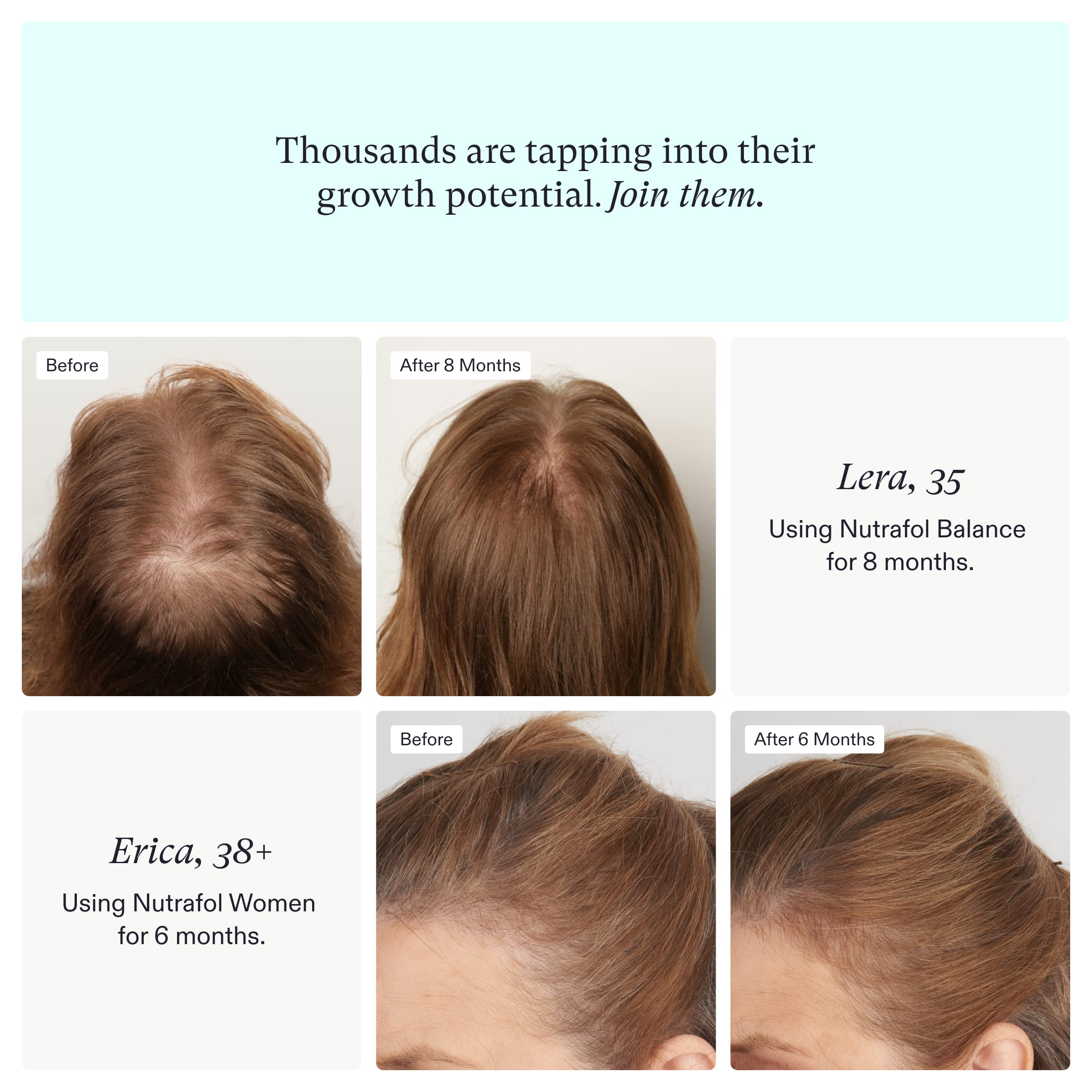 Nutrafol Hair Growth Supplement Bundle | Women Ages 18-44 + Womens Ages 45+ | Clinically Proven
